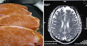 Teen Has Seizures And Dies After Doctors Discover Tapeworm Eggs In Brain From Deathly Pork Mistake Teen Has Seizures And Dies After Doctors Discover Tapeworm Eggs In Brain From Deathly Pork Mistake