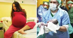 Doctors in Delivery Room Witness 23-Year-Old Mom's Extraordinary Birth Doctors in Delivery Room Witness 23-Year-Old Mom's Extraordinary Birth