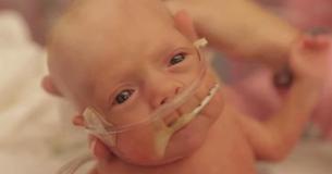 When This Baby Was Born 3.5 Months Early His Father Decided To Film His Extraordinary 1st Year When This Baby Was Born 3.5 Months Early His Father Decided To Film His Extraordinary 1st Year