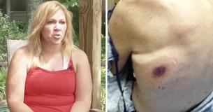 Padre muere 48 horas después de contraer una bacteria come carne en Florida, su hija está advirtiendo a todo el mundo Padre muere 48 horas después de contraer una bacteria come carne en Florida, su hija está advirtiendo a todo el mundo