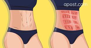 Dicas para ter uma barriga chapada depois dos 40 Dicas para ter uma barriga chapada depois dos 40
