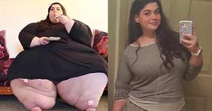 Mujer de 300 kilos perdió 121 kilos en solo un año Mujer de 300 kilos perdió 121 kilos en solo un año