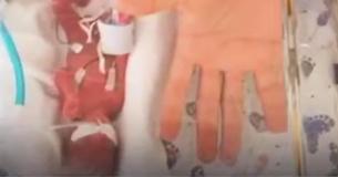 Un bebé de 368 gramos murió después de recibir amor y cuidado durante 25 días Un bebé de 368 gramos murió después de recibir amor y cuidado durante 25 días