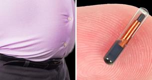 Scientists Are Working On A Chip That Zaps People To Help Them Combat The Scourge Of Obesity Scientists Are Working On A Chip That Zaps People To Help Them Combat The Scourge Of Obesity