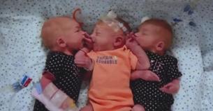 Woman Believed She Had Kidney Stones But Ends Up Giving Birth To Triplets Woman Believed She Had Kidney Stones But Ends Up Giving Birth To Triplets