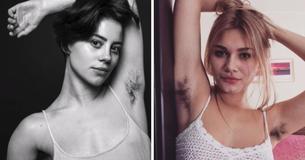 As mulheres estão dando uma resposta ao estigma dos pelos corporais, publicando fotos de As mulheres estão dando uma resposta ao estigma dos pelos corporais, publicando fotos de
