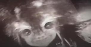Mom Is Startled And Delighted By Unborn Baby's Face On Ultrasound Mom Is Startled And Delighted By Unborn Baby's Face On Ultrasound