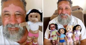 A Grandfather In Brazil With Vitiligo Makes Inclusive Dolls For Children With The Condition A Grandfather In Brazil With Vitiligo Makes Inclusive Dolls For Children With The Condition