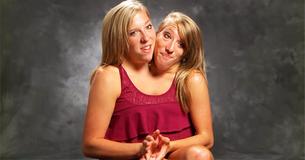 Conjoined Twins Abby And Brittany Hensel Hired As Math Teachers In Minnesota Conjoined Twins Abby And Brittany Hensel Hired As Math Teachers In Minnesota