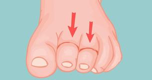 Mother Is Pushing Parents Everywhere To Check Their Baby’s Toes For Tangled Hairs Mother Is Pushing Parents Everywhere To Check Their Baby’s Toes For Tangled Hairs