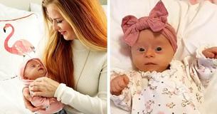 Une maman pour la première fois a publié un avis sur sa magnifique fille atteinte du syndrome de Down Une maman pour la première fois a publié un avis sur sa magnifique fille atteinte du syndrome de Down
