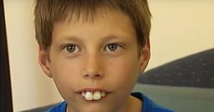 Los niños se burlaban de él por sus dientes, pero le donaron 100.000 dólares para darle la mejor sonrisa Los niños se burlaban de él por sus dientes, pero le donaron 100.000 dólares para darle la mejor sonrisa