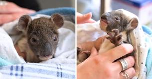 Orphaned Baby Koala Is Fitted With A Tiny Arm-Cast After She Fell From A Tree Orphaned Baby Koala Is Fitted With A Tiny Arm-Cast After She Fell From A Tree