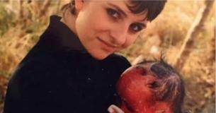 Un bébé était censé être caché en raison d'une maladie rare qui cause un renouvellement de peau 10 fois plus rapide que la norme Un bébé était censé être caché en raison d'une maladie rare qui cause un renouvellement de peau 10 fois plus rapide que la norme