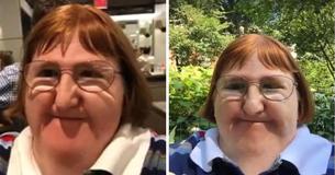 Disabled Woman Told She's ”Too Ugly” To Take Selfies But Refuses To Be Bullied By Negative Comments Disabled Woman Told She's ”Too Ugly” To Take Selfies But Refuses To Be Bullied By Negative Comments