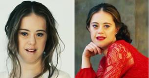 Una campeona de gimnasia con síndrome de Down se convierte en modelo y derriba todos los estereotipos Una campeona de gimnasia con síndrome de Down se convierte en modelo y derriba todos los estereotipos