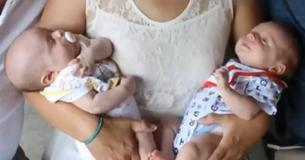 Una mujer da a luz a gemelos de dos padres diferentes Una mujer da a luz a gemelos de dos padres diferentes