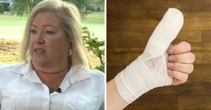 Woman Contracts Flesh-Eating Bacteria And Nearly Loses Arm After Visit To Nail Salon Woman Contracts Flesh-Eating Bacteria And Nearly Loses Arm After Visit To Nail Salon