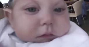 Jaxon Buell The Boy Born Missing Most Of Brain And Skull Has Passed Away Aged 5 Jaxon Buell The Boy Born Missing Most Of Brain And Skull Has Passed Away Aged 5
