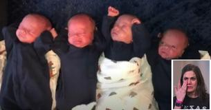 Une naissance rare d'un quadruplés identiques au milieu de la pandémie Une naissance rare d'un quadruplés identiques au milieu de la pandémie