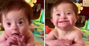 Une petite fille trisomique attire les regards après avoir fait sourire à sa mère adoptive Une petite fille trisomique attire les regards après avoir fait sourire à sa mère adoptive