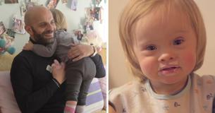 Ein alleinerziehender Vater adoptiert ein kleines Mädchen mit Down-Syndrom, nachdem sie von ihrer eigenen Mutter und 20 weiteren Familien abgelehnt wurde Ein alleinerziehender Vater adoptiert ein kleines Mädchen mit Down-Syndrom, nachdem sie von ihrer eigenen Mutter und 20 weiteren Familien abgelehnt wurde
