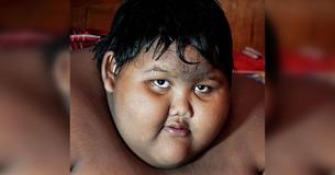 'World's Fattest Boy' Shows Off Trim Physique After Losing Over 220 Pounds 'World's Fattest Boy' Shows Off Trim Physique After Losing Over 220 Pounds