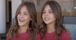 Les « plus belles jumelles du monde », Ava Marie et Leah Rose ont grandi aujourd'hui Les « plus belles jumelles du monde », Ava Marie et Leah Rose ont grandi aujourd'hui
