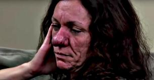 Woman’s Life-Altering Surgery On Her Nose Wholly Transformed Her Appearance Woman’s Life-Altering Surgery On Her Nose Wholly Transformed Her Appearance