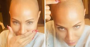 Jada Pinkett Smith Says Her And Alopecia Jada Pinkett Smith Says Her And Alopecia