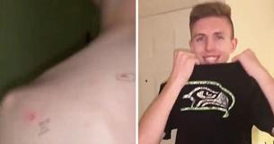 Homem retorna da dermatologista com anotações sobre seu corpo após esposa desenhar círculos de potencial de câncer nas costas dele Homem retorna da dermatologista com anotações sobre seu corpo após esposa desenhar círculos de potencial de câncer nas costas dele
