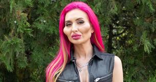 Model With 'World's Biggest Cheeks' Shows The Way She Looked Before Transformation Model With 'World's Biggest Cheeks' Shows The Way She Looked Before Transformation