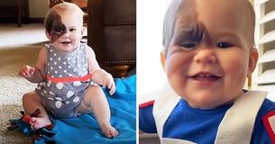 De uma maneita linda, mãe se dedica a compartilhar a marca de nascença rara de sua filha De uma maneita linda, mãe se dedica a compartilhar a marca de nascença rara de sua filha