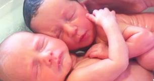 I gemelli neonati si abbracciavano per la vita nel grembo materno e si cercano dopo la nascita I gemelli neonati si abbracciavano per la vita nel grembo materno e si cercano dopo la nascita