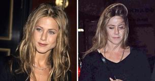 A 'tristeza' de Jennifer Aniston com mulheres que recorrem à cirurgia plástica para lidar com suas inseguranças A 'tristeza' de Jennifer Aniston com mulheres que recorrem à cirurgia plástica para lidar com suas inseguranças