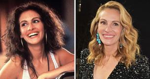 Julia Roberts rimane critica nei confronti della chirurgia plastica, preferendo invecchiare naturalmente Julia Roberts rimane critica nei confronti della chirurgia plastica, preferendo invecchiare naturalmente