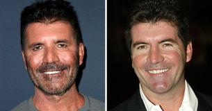 Simon Cowell hat aufgehört, Filler zu verwenden, nachdem sein Sohn wegen seines verpfuschten Äußeren hysterisch wurde Simon Cowell hat aufgehört, Filler zu verwenden, nachdem sein Sohn wegen seines verpfuschten Äußeren hysterisch wurde