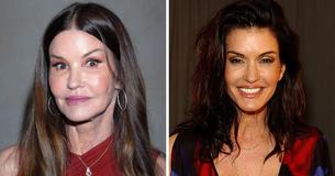 Supermodel Janice Dickinson Says ‘I Live For Plastic Surgery’ But Denies Having Some Procedures Done Supermodel Janice Dickinson Says ‘I Live For Plastic Surgery’ But Denies Having Some Procedures Done