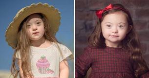 Una modella di 5 anni con la sindrome di Down conquista il cuore del pubblico sfidando gli stereotipi di bellezza Una modella di 5 anni con la sindrome di Down conquista il cuore del pubblico sfidando gli stereotipi di bellezza