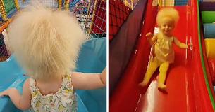 Toddler Born With Rare Hair Syndrome Is One Of Roughly 100 Confirmed Cases Worldwide Toddler Born With Rare Hair Syndrome Is One Of Roughly 100 Confirmed Cases Worldwide