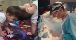 Conjoined Twins, 3, Are Separated In Historic Surgery That Utilized Virtual Reality Conjoined Twins, 3, Are Separated In Historic Surgery That Utilized Virtual Reality