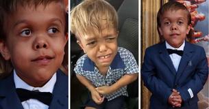 Bullied For His Dwarfism, Quaden Bayles Is Now A Red Carpet Star Bullied For His Dwarfism, Quaden Bayles Is Now A Red Carpet Star