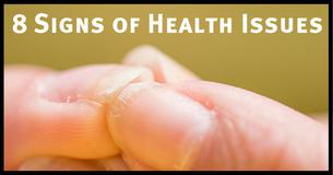 8 Signs Of Health Issues You Can Spot On Your Fingernails 8 Signs Of Health Issues You Can Spot On Your Fingernails