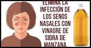¡Cómo deshacerse de una infección de los senos nasales en minutos con vinagre de sidra de manzana ¡Cómo deshacerse de una infección de los senos nasales en minutos con vinagre de sidra de manzana
