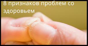 8 признаков проблем со здоровьем, которые можно заметить по ногтям 8 признаков проблем со здоровьем, которые можно заметить по ногтям