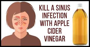 How To Kill Sinus Infection Within Minutes With Apple Cider Vinegar How To Kill Sinus Infection Within Minutes With Apple Cider Vinegar