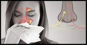 Therapist Shares How To Immediately Clear Your Sinuses In Two Steps Therapist Shares How To Immediately Clear Your Sinuses In Two Steps
