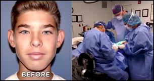 Teen Gets Bullied For His Appearance So Mom Allows Plastic Surgery Teen Gets Bullied For His Appearance So Mom Allows Plastic Surgery