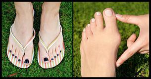 You'll Never Want To Wear Flip-Flops Again After Reading This You'll Never Want To Wear Flip-Flops Again After Reading This
