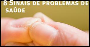 8 Sinais de problemas de saúde que você pode detectar em suas unhas 8 Sinais de problemas de saúde que você pode detectar em suas unhas